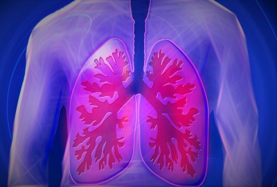 COPD - Eine unterschätzte Lungenerkrankung